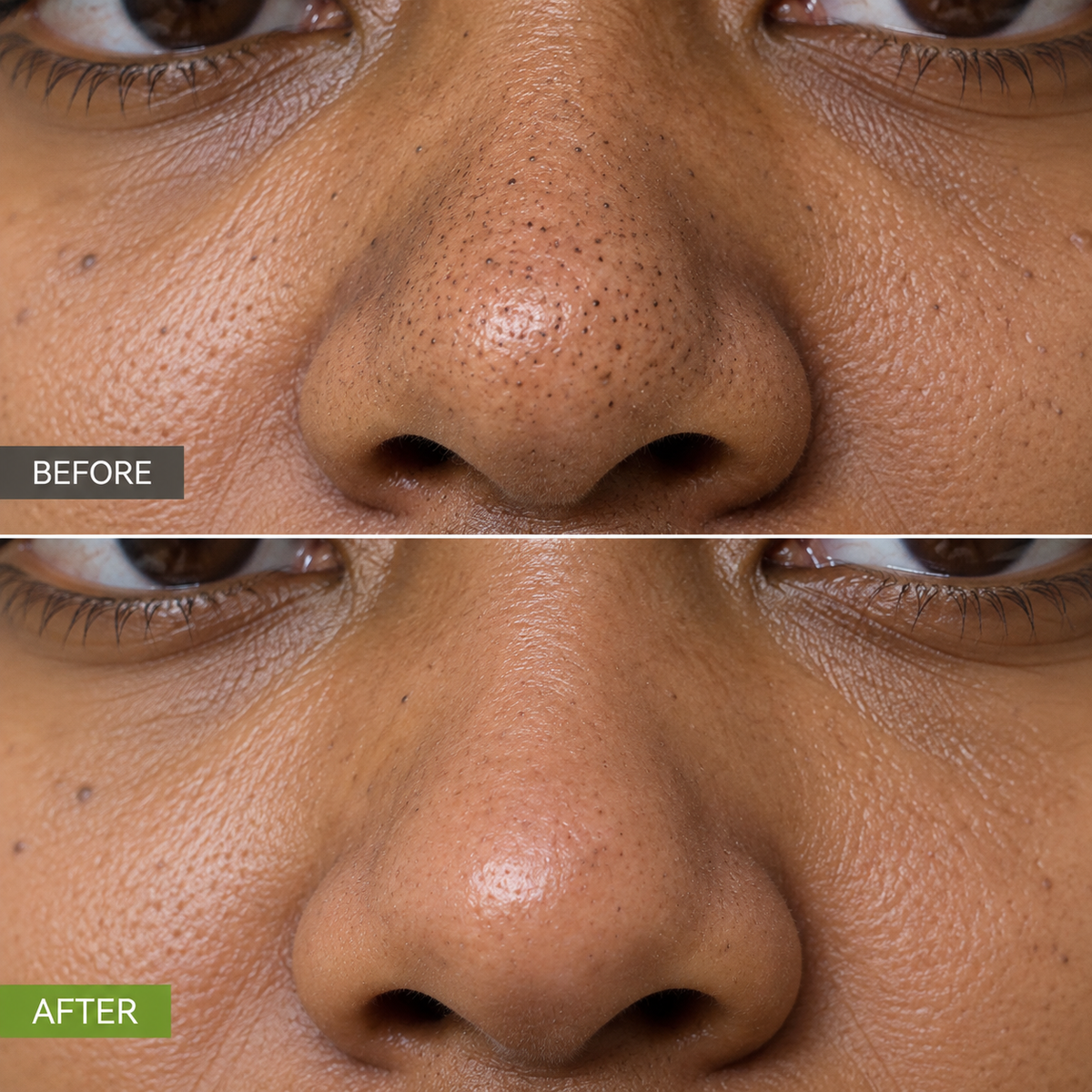 Pore Detox Kit | Pack mascarilla con tiras + sérum para puntos negros y filamentos sebáceos – LANBENA