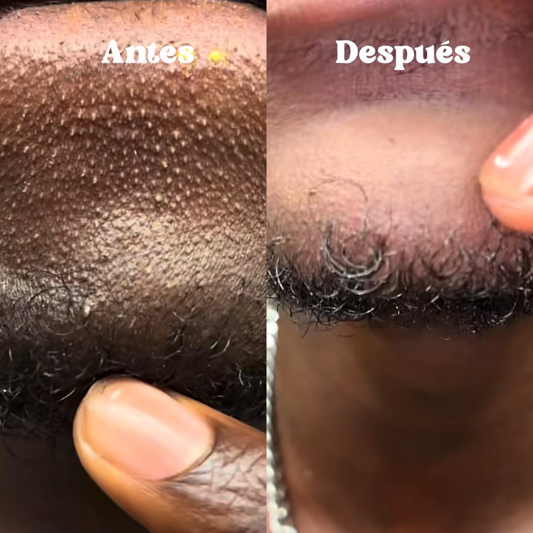 Exfoliante Facial de arroz - Melao Rice & Black Rice