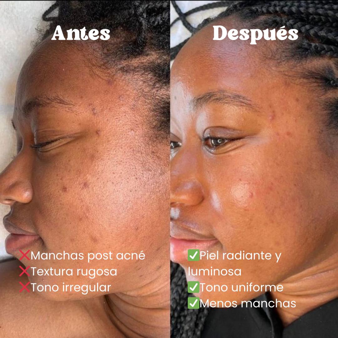 Exfoliante Facial de arroz - Melao Rice & Black Rice