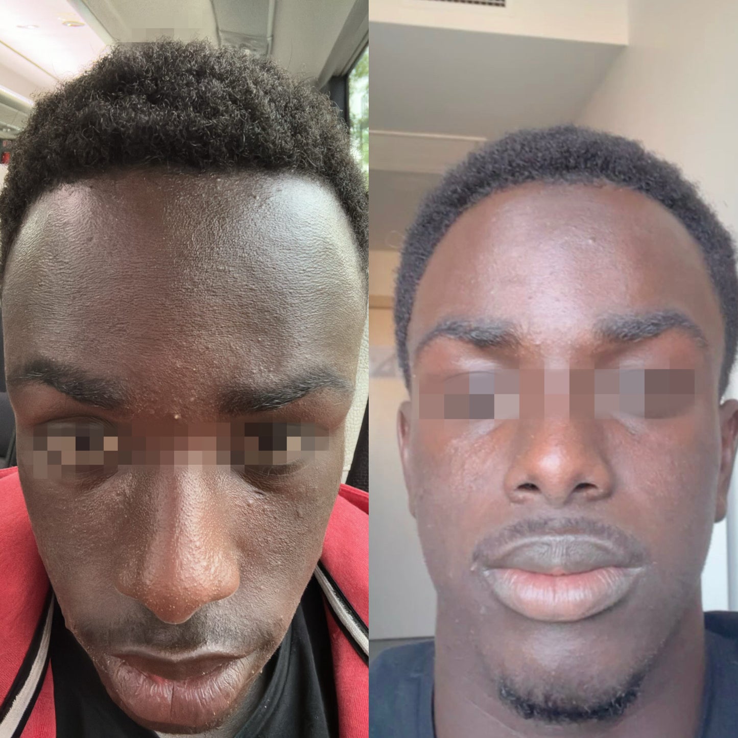 Asesoría de Skincare personalizada – clásico