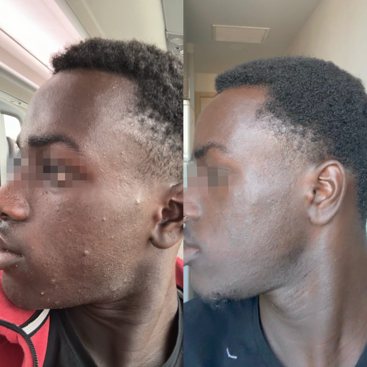 Asesoría de Skincare personalizada – clásico