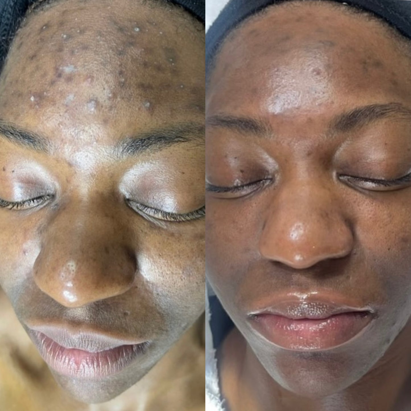 Asesoría de Skincare personalizada – clásico