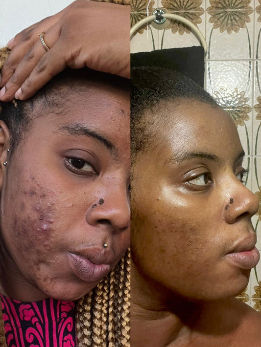 Asesoría de Skincare personalizada – clásico