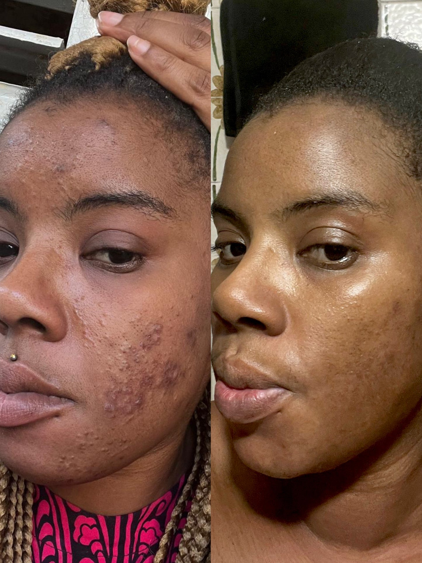 Asesoría de Skincare personalizada – clásico