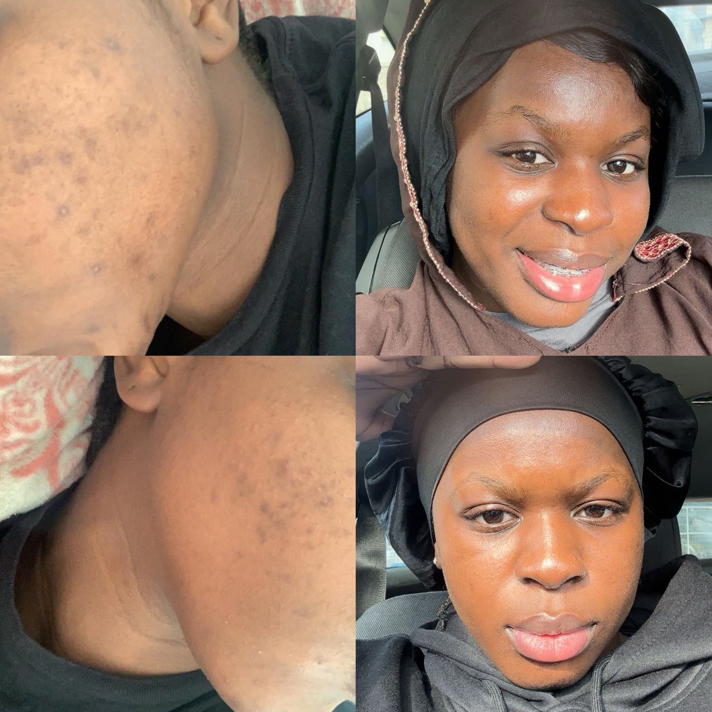 Asesoría de Skincare personalizada – clásico