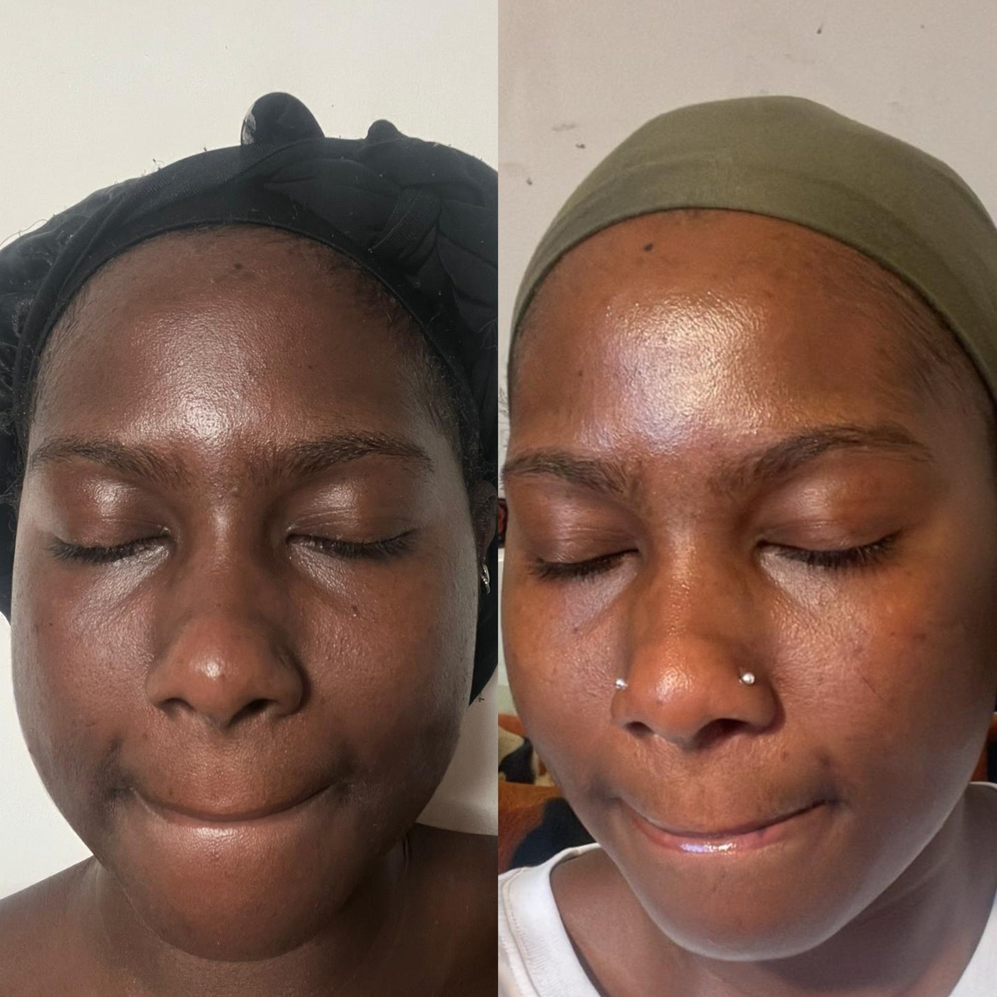 Asesoría de Skincare personalizada – clásico